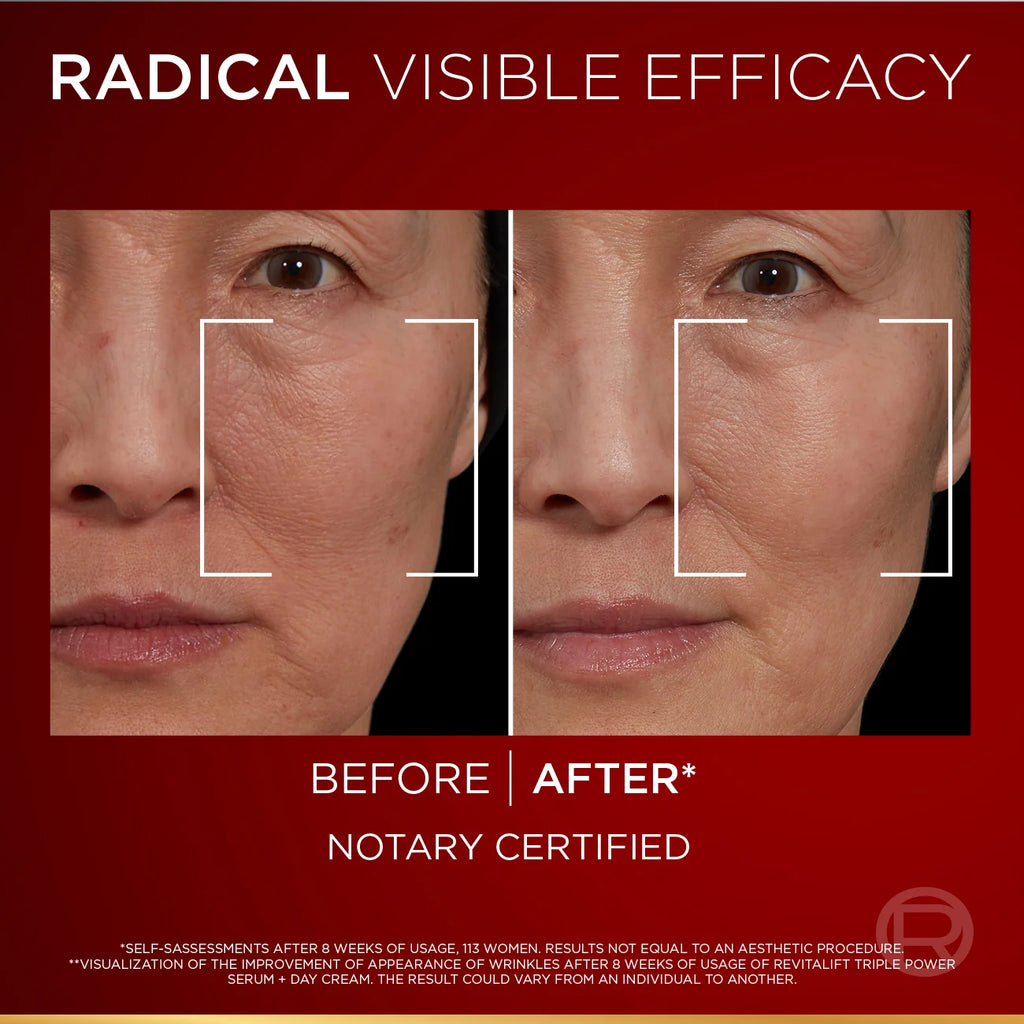 L’Oréal Paris Revitalift Triple Power Age-Correcting™ Serum with Tri-peptides, Hyaluronic Acid, and Vitamin C