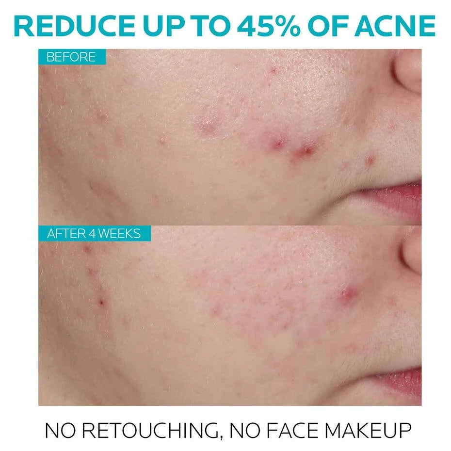 LRP Effaclar ULTRA CONCENTRATED SERUM